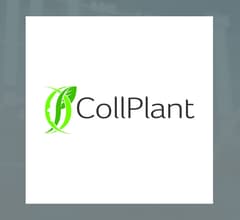 Image about Alvopetro Energy (CVE:ALV) Reaches New 1-Year High  – Still a Buy?