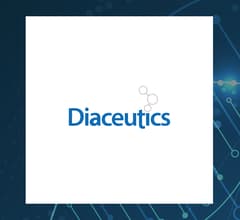 Image for Diaceutics (LON:DXRX)  Shares Down 0.6%   – Time to Sell?