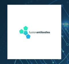 Image for Fusion Antibodies (LON:FAB) Trading Up 4%  – Time to Buy?