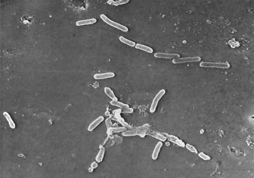 This scanning electron microscope image made available by the Centers for Disease Control and Preve…
