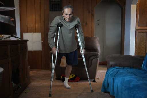 Blas Sanchez prepares to put on a prosthetic Friday, January 26, 2024, in Winslow, Ariz