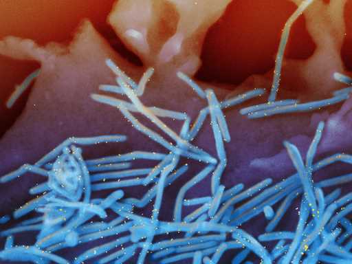 This electron microscope image provided by the National Institutes of Health shows human respirator…