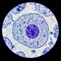 Microscope Footage Shows Immune Cells Destroying Cancer