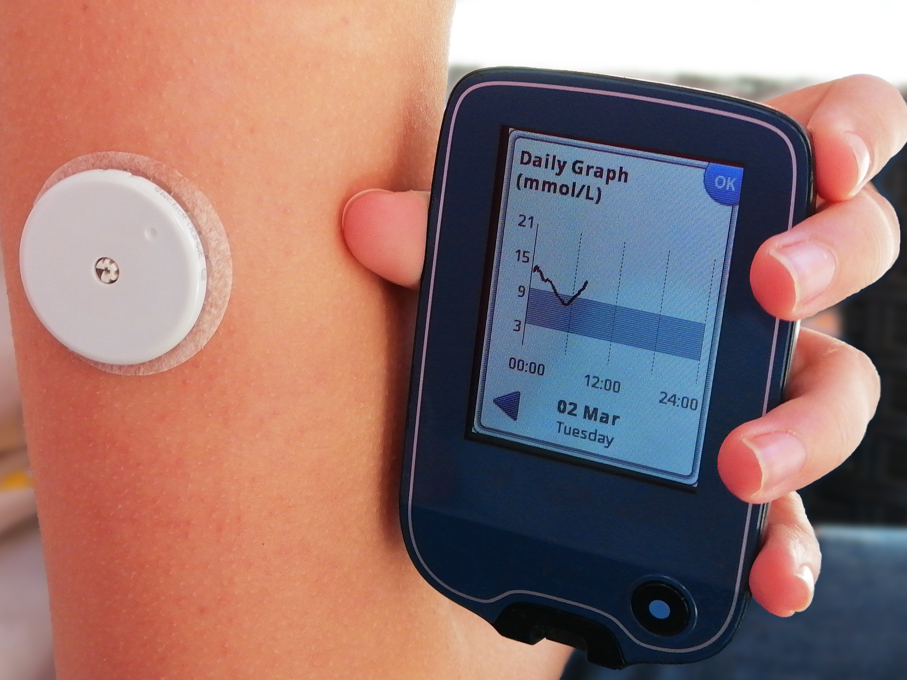 close-up image of glucose monitoring system on arm