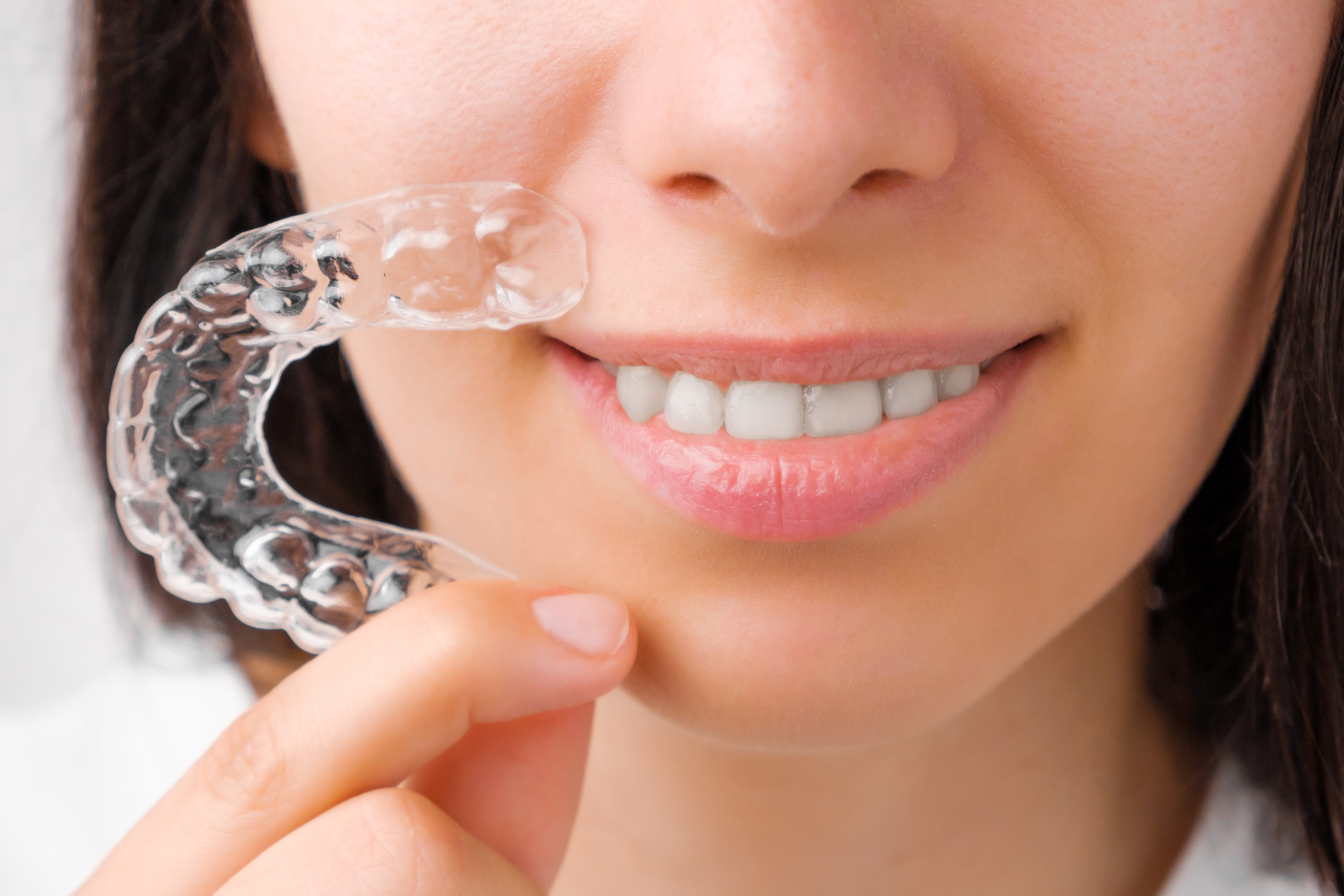 Align Technology: Biting into growth, one aligner at a time