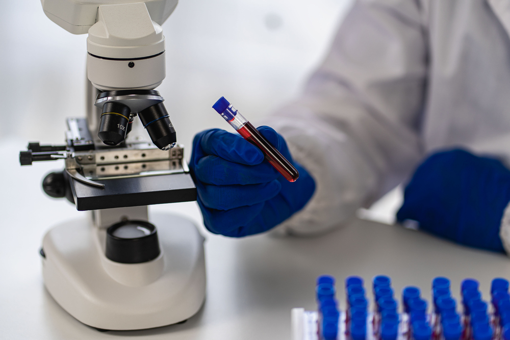 Vascular health doctor in clinical laboratory for medical research and development concepts. and science with a microscope and a test tube placed beside it - stock image