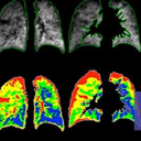 Polarean Imaging