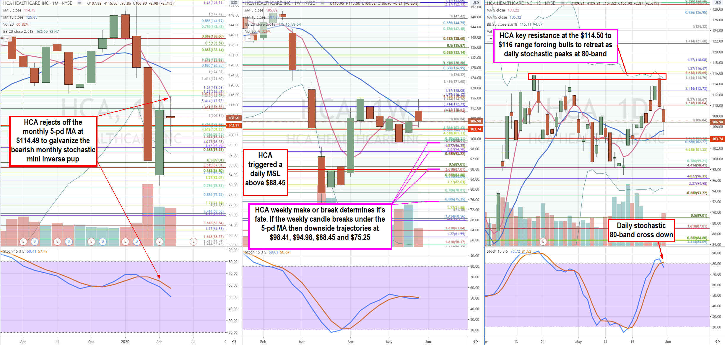 HCA Healthcare (NYSE: HCA) Stock is Already Overvalued 