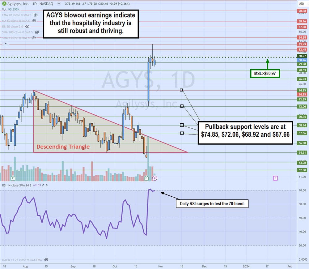 agys stock chart