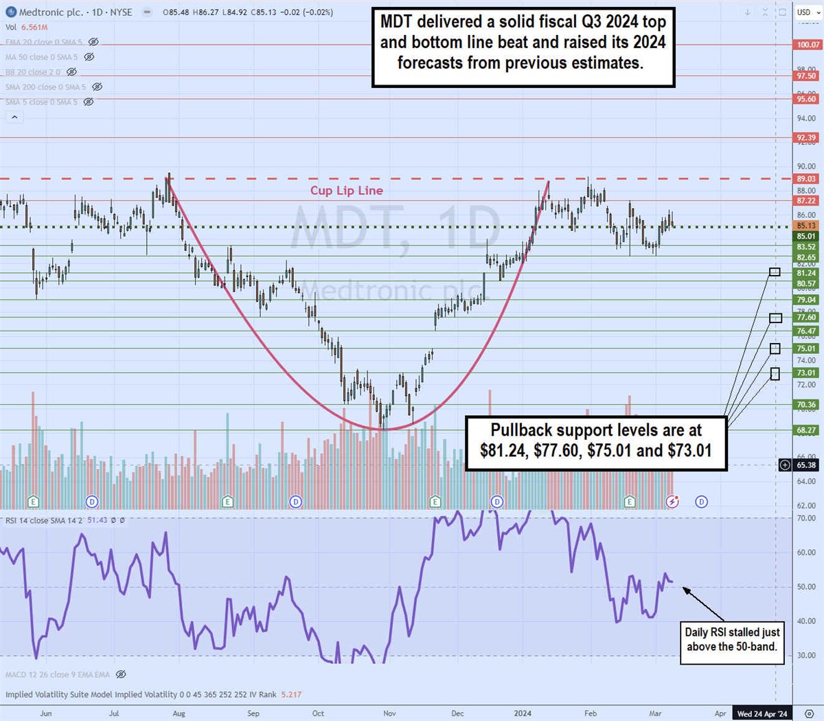 mdt stock daily cup pattern