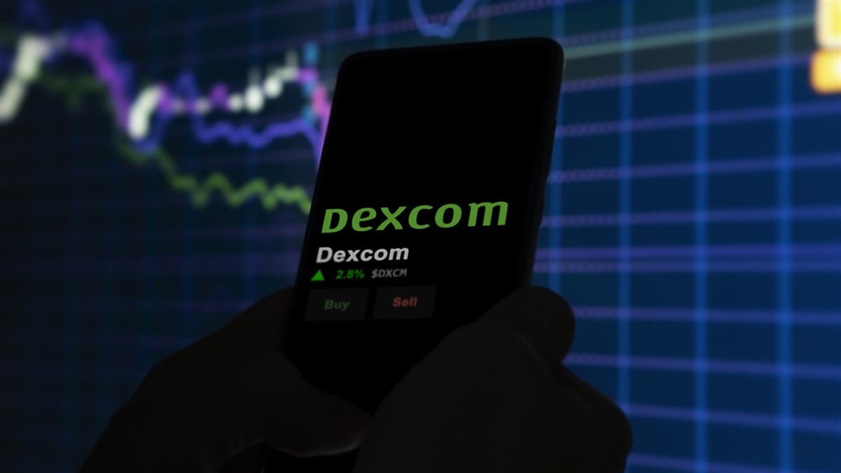 DEXCOM stock outlook 