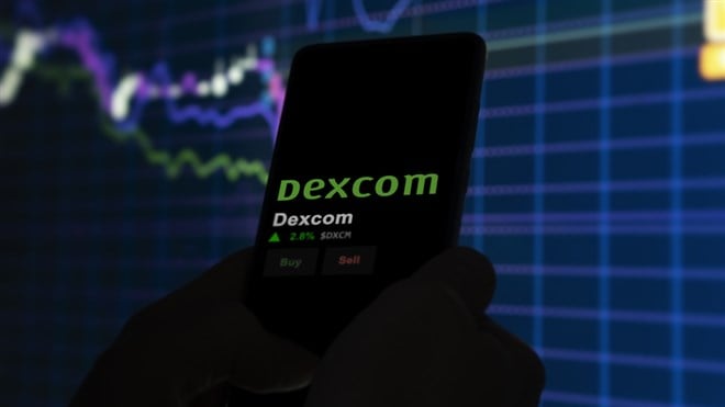 DEXCOM stock outlook 