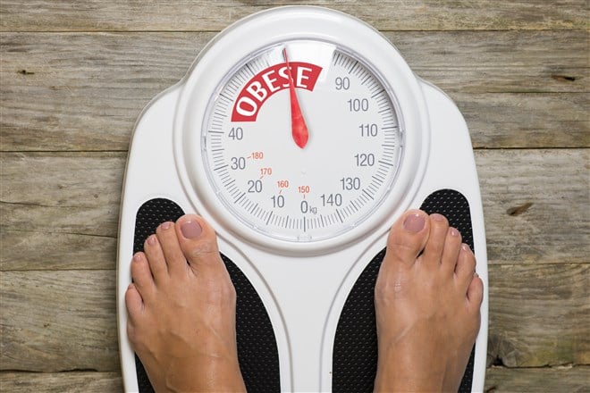 photo of feet on scale with scale reading obese
