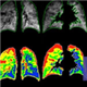 Polarean Imaging plc stock logo